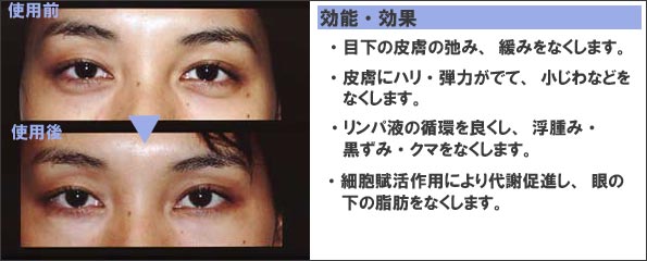 アイスラック2 【目の下のたるみに】