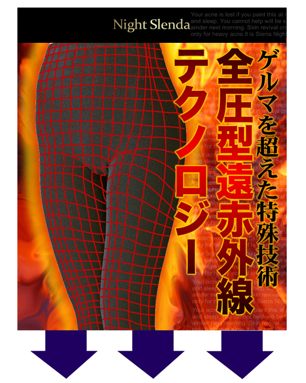 �i�C�g�X�����_