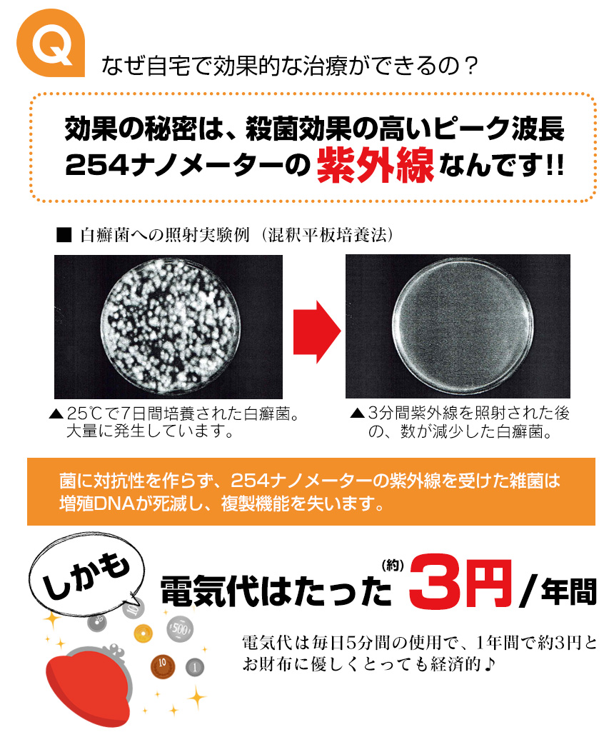 家庭用紫外線治療器 NewUVエミッター☆カユイ足裏や指の間の水虫、シツコイ爪水虫などでお悩みの方に！